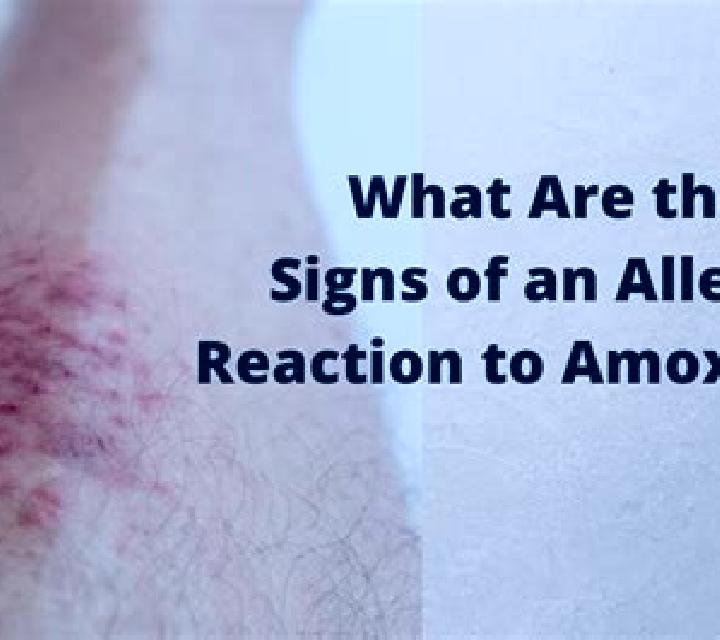 Amoxil allergic reaction to amoxil medication