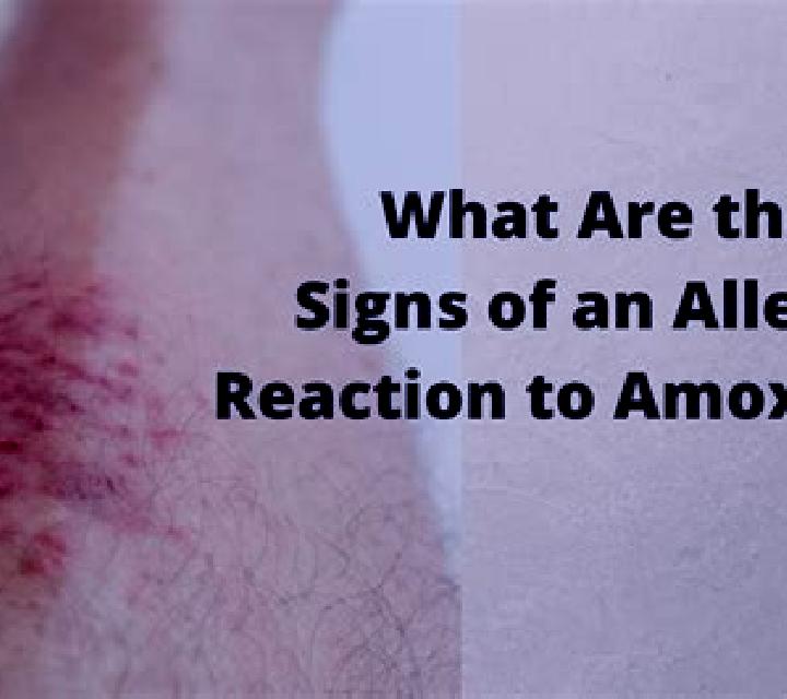 Amoxil allergic reaction to amoxil pharmacy