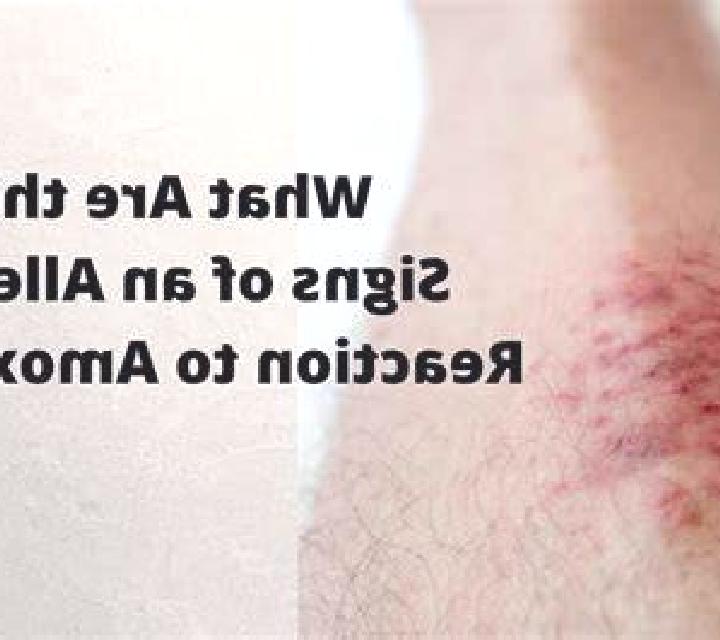 Amoxil allergic reaction to amoxil tablet