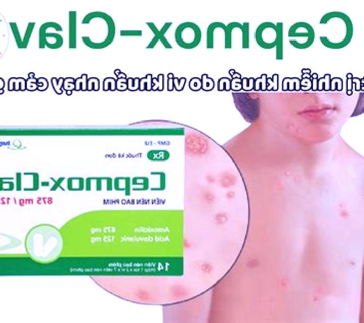 Cepmox pills