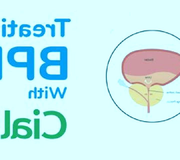 Cialis cialis for bph how long to work medication