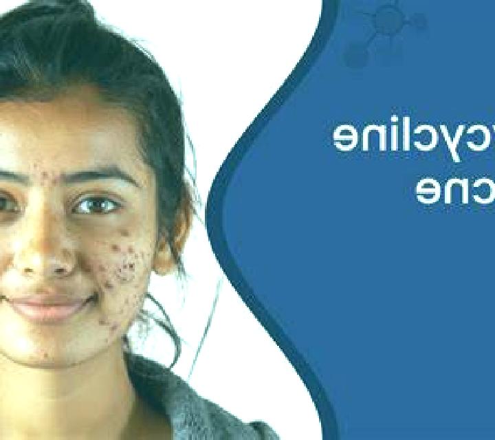 Doxycycline doxycycline for acne pills
