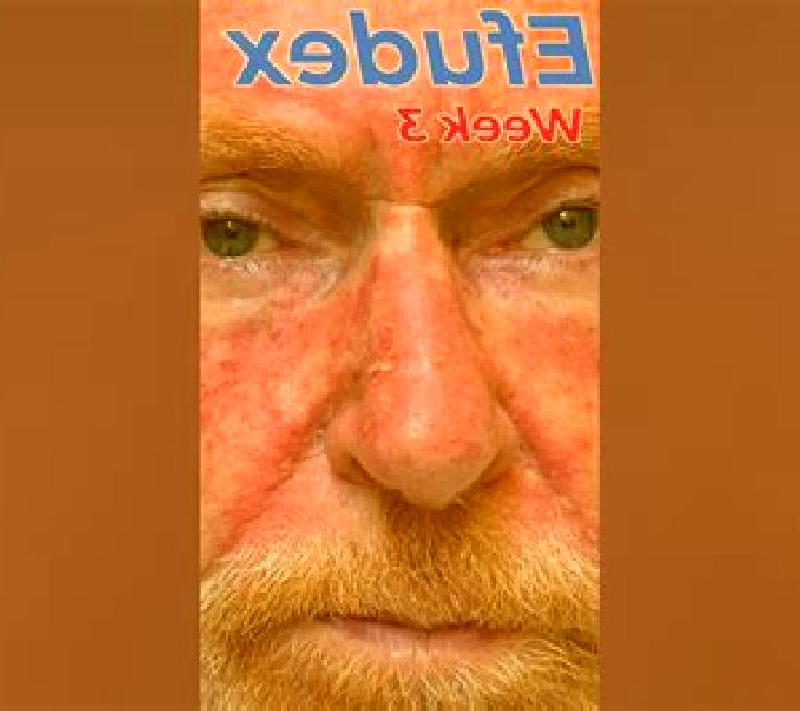 Efudex tablet