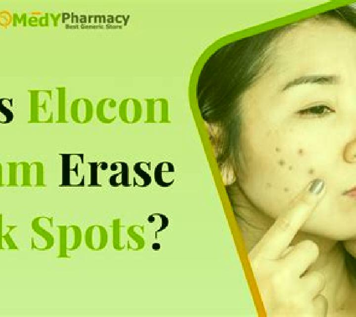 Elocon pharmacy