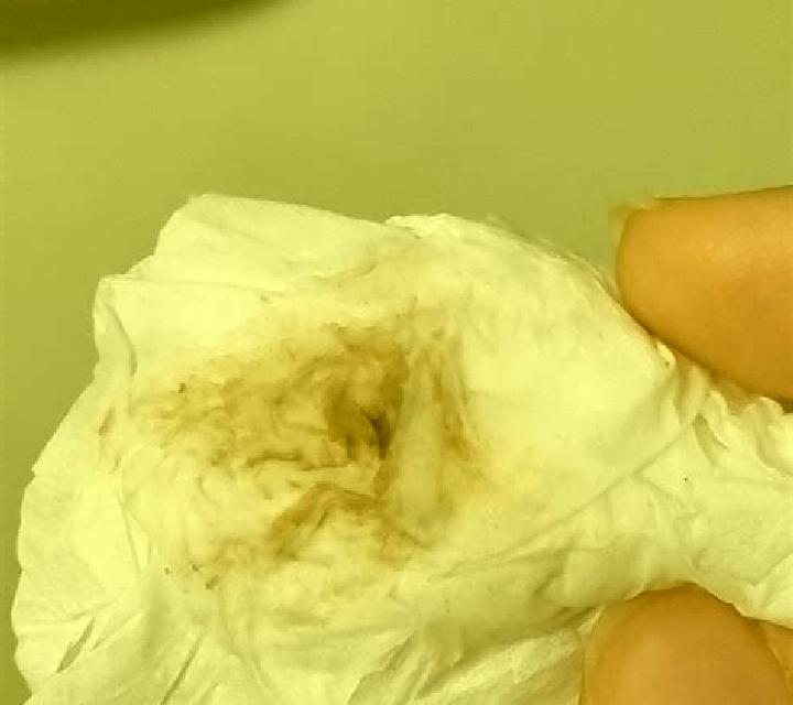 Flagyl brown discharge after flagyl pills