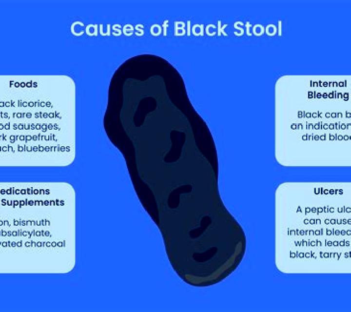Flagyl can flagyl cause dark stool pharmacy