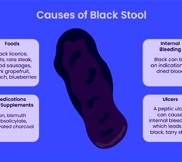 Flagyl does cipro or flagyl cause dark stools pharmacy