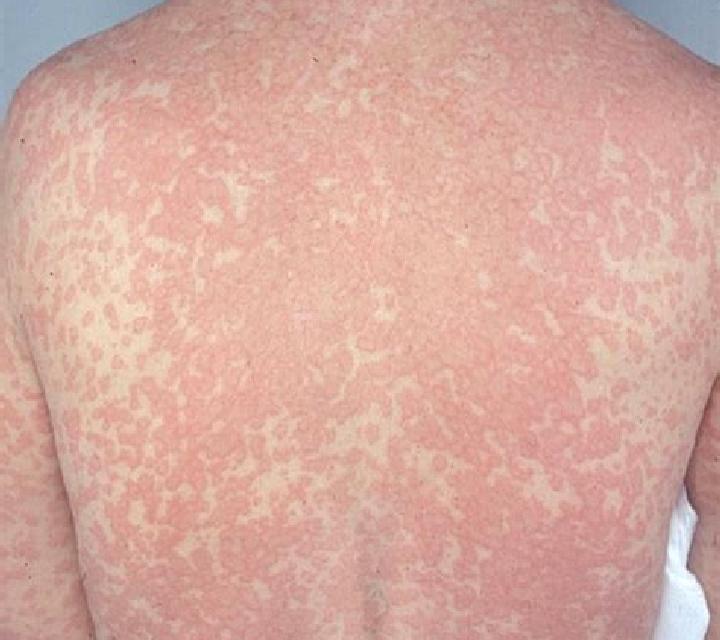 Flagyl does drinking alcohol interfere with flagyl gel tablet