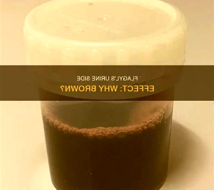Flagyl does flagyl turn urine brown medication