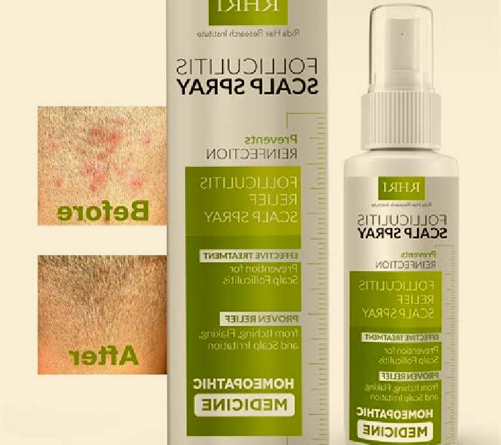 Flagyl flagyl itchy scalp medication