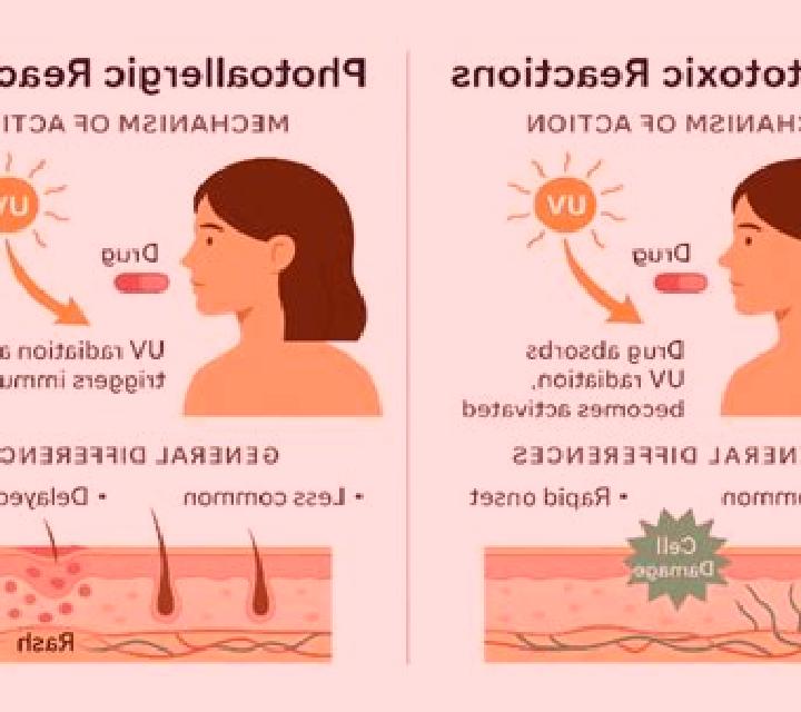 Flagyl flagyl photosensitivity pharmacy
