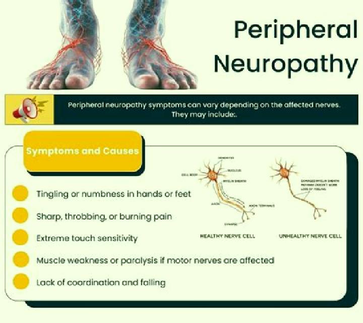 Flagyl flagyl side effects peripheral neuropathy pharmacy