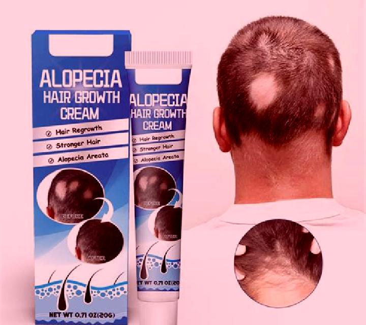 Hair Loss Cream pills