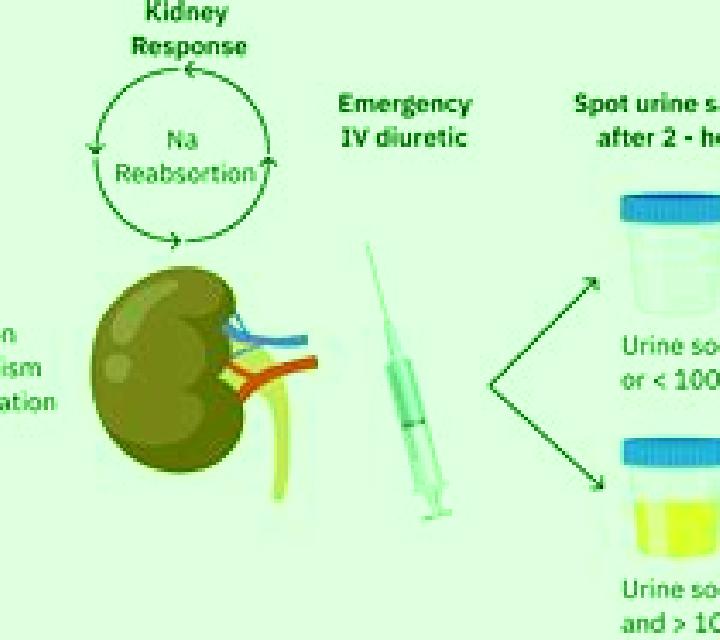 Lasix acute renal failure and lasix pills