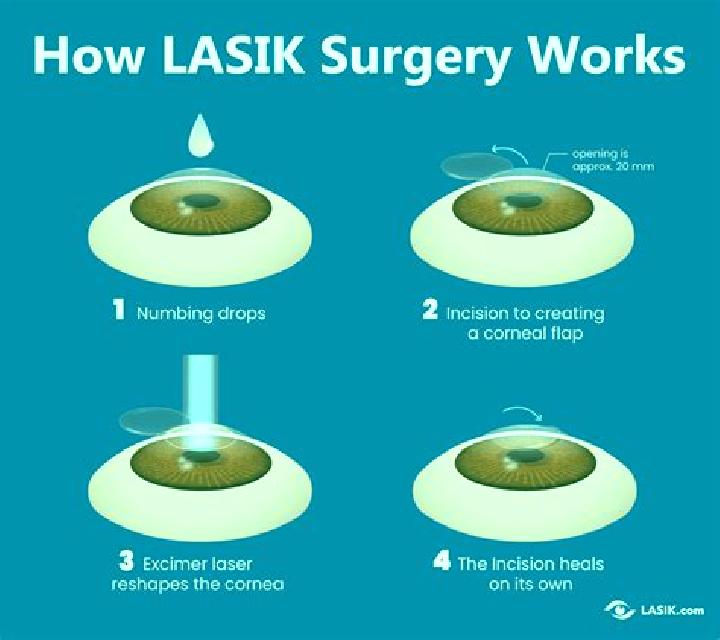 Lasix eye surgery lasix medication