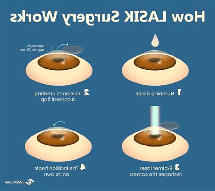 Lasix eye surgery lasix pharmacy