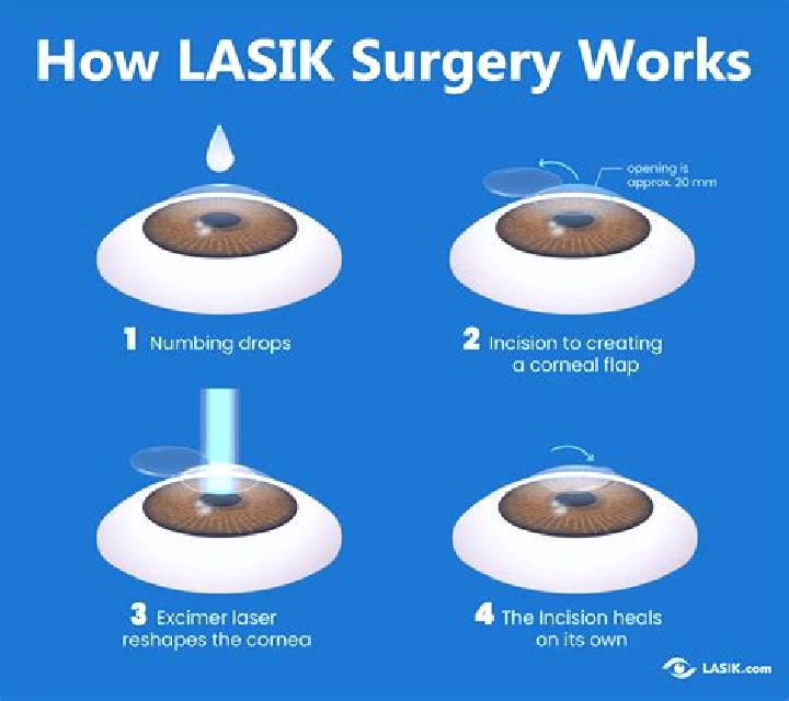 Lasix eye surgery lasix pills