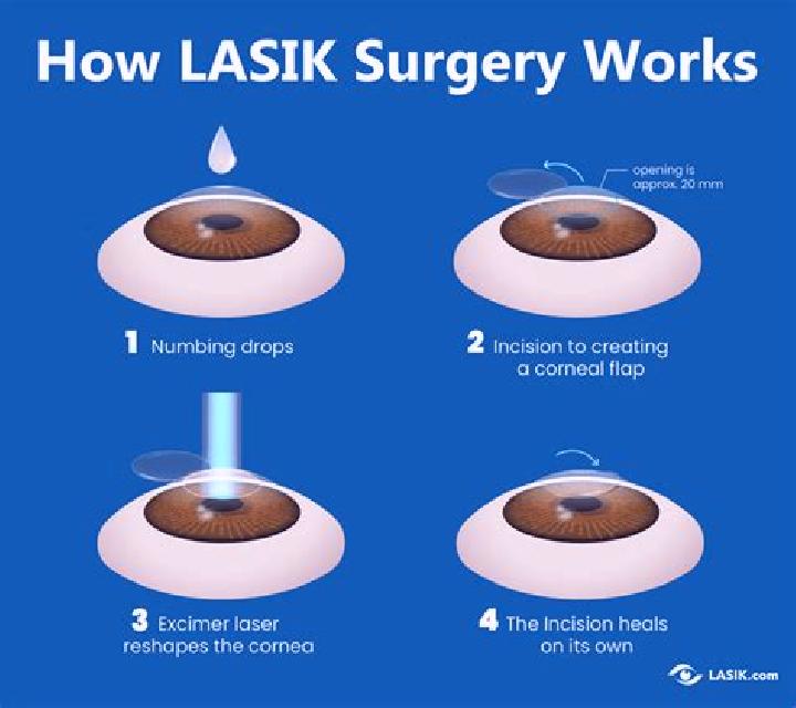Lasix is lasix good for far sighted vison tablet