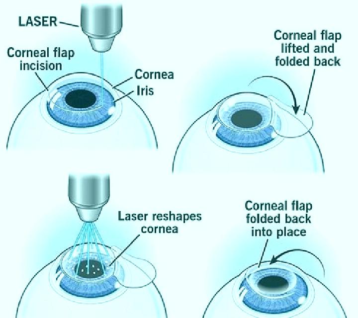 Lasix lasix after ablation pills
