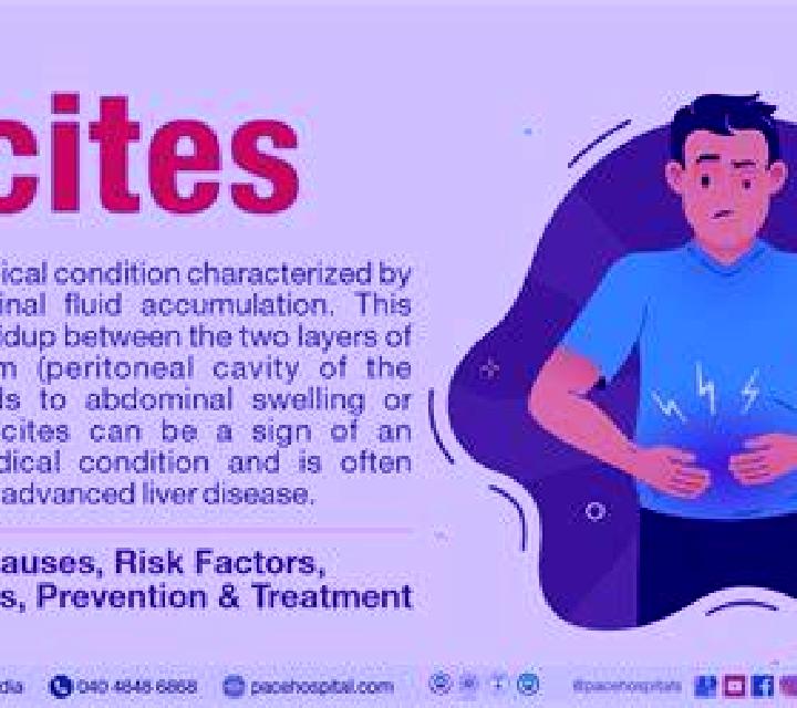 Lasix lasix ascites medication