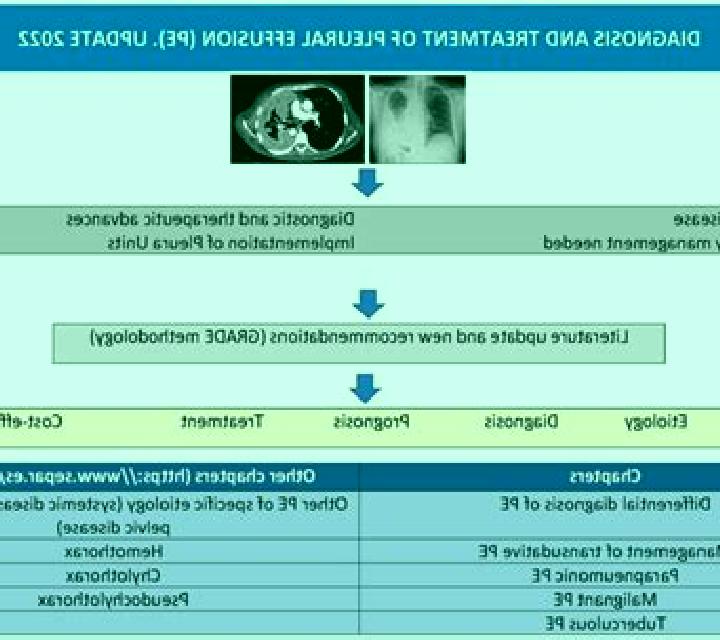 Lasix lasix dose for pleural effusion medication