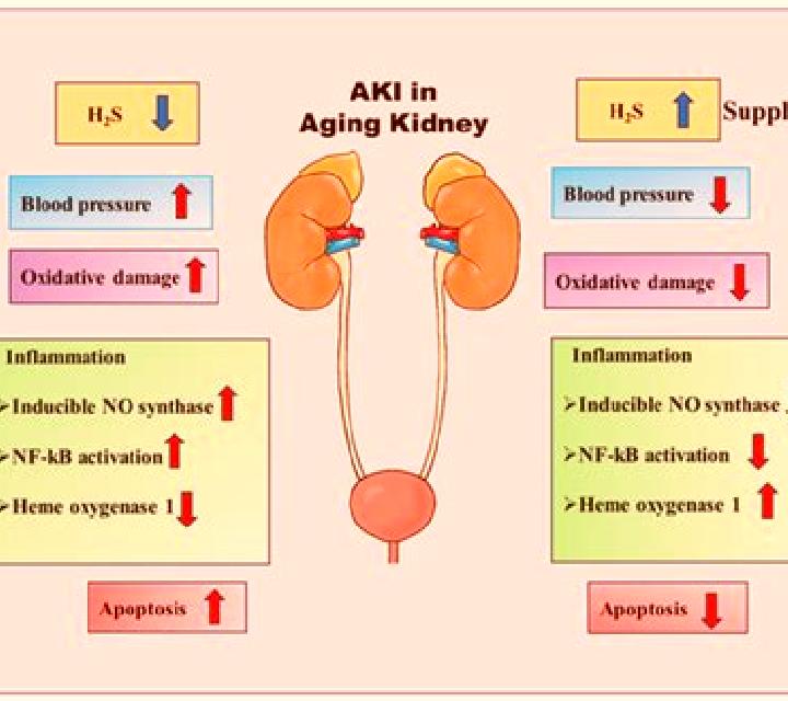 Lasix lasix in acute renal failure pills