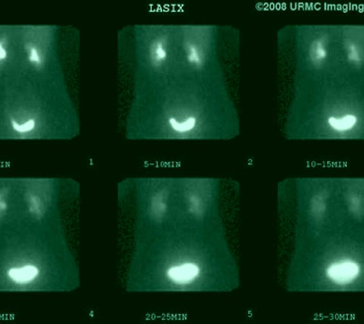Lasix lasix scan radiology pills