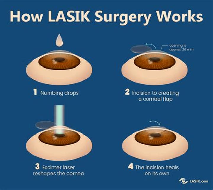Lasix lasix surgery price gold coast tablet