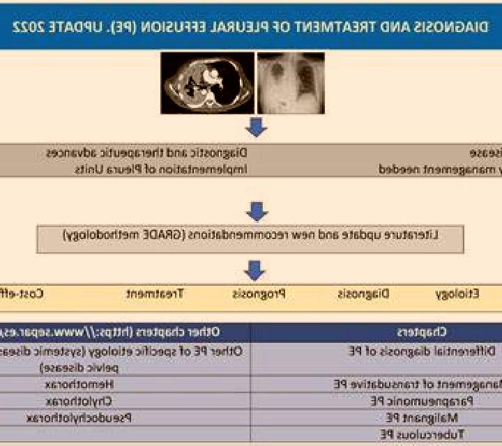 Lasix pleural effusion treatment lasix medication