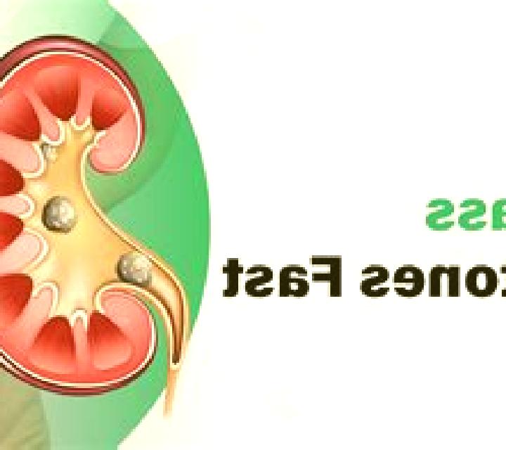 Lasix will lasix help pass a kidney stone medication