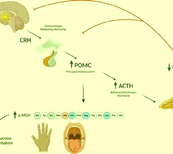 Prednisolone acth prednisolone pathway pills