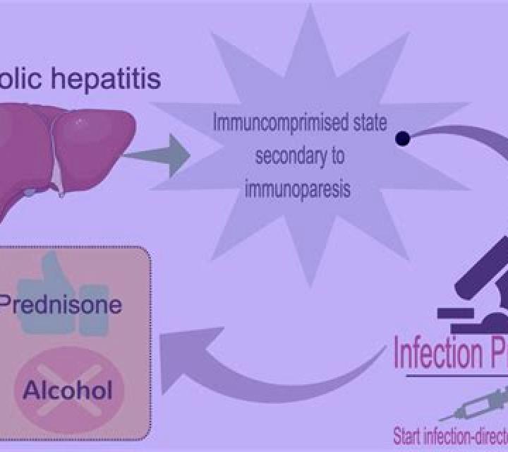 Prednisolone alcoholic hepatitis with prednisolone tablet