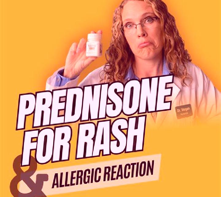 Prednisolone allergic conjunctivitis prednisolone pills