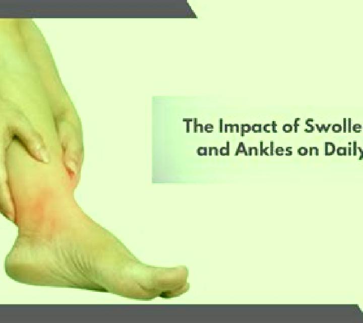 Prednisolone can prednisolone help swollen ankles medication