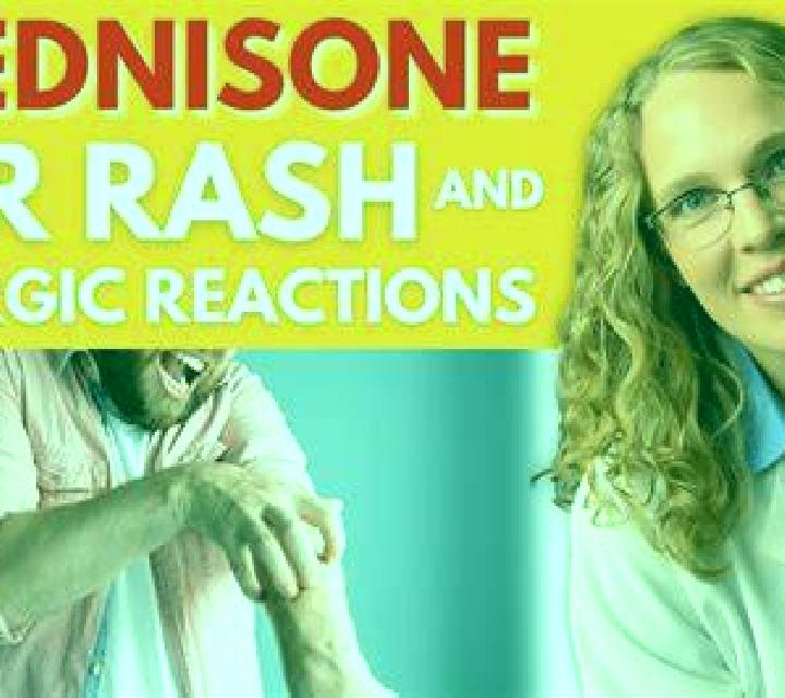 Prednisolone cold hands after taking prednisolone pharmacy