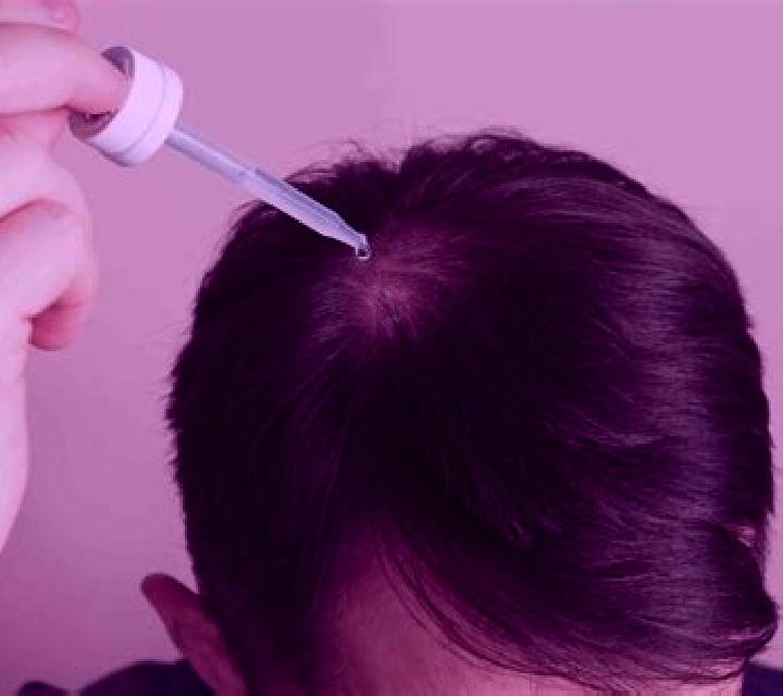 Prednisolone prednisolone affecting hair medication