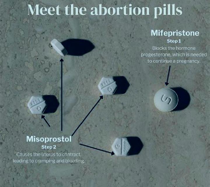 Prednisolone prednisolone and recurrent miscarriage pills
