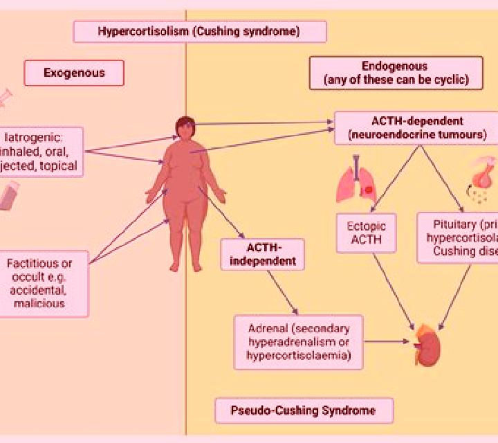 Prednisolone prednisolone causing cushings syndrome pills