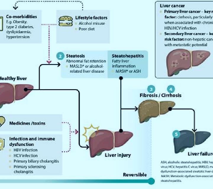Prednisolone prednisolone effect on liver medication