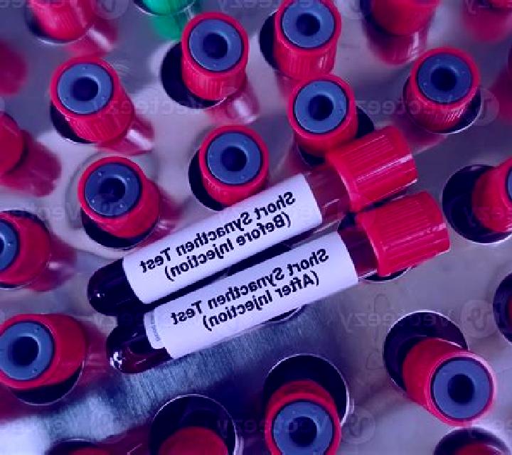 Prednisolone stop prednisolone before synacthen test medication