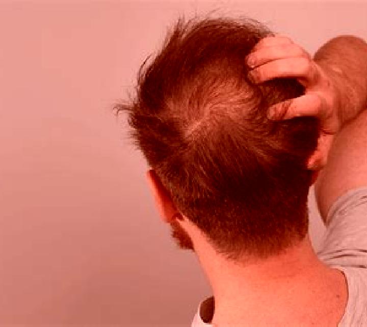 Propecia does hairfall stop immediately after taking propecia tablet