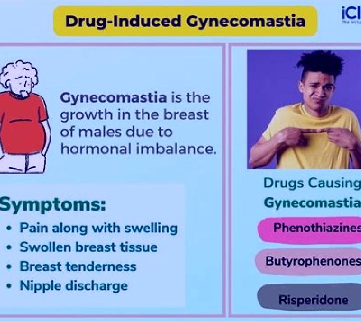 Propecia propecia induced gynecomastia pills