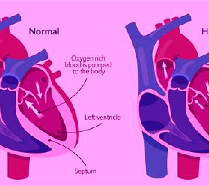 Provigil provigil heart problems pharmacy