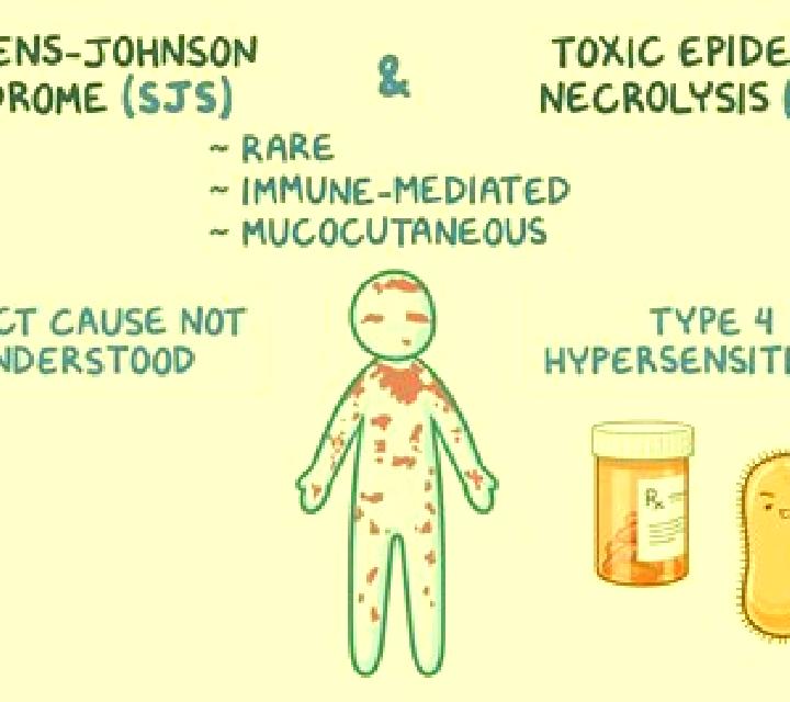 Provigil stevens johnson syndrome provigil pills