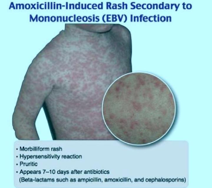 Xenical xenical 120 mg amazon pharmacy